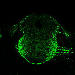 Protein expression in the human embryonic spinal cord