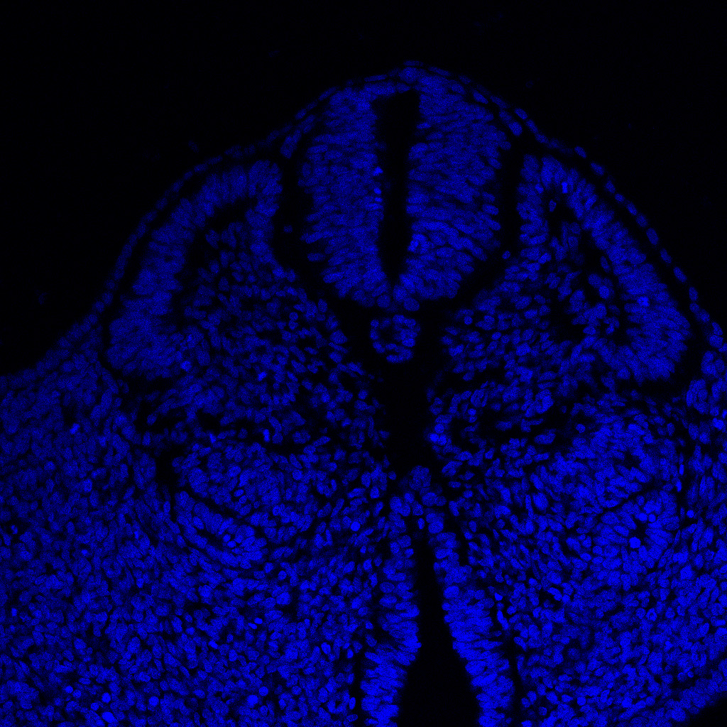 Protein expression in the human embryonic spinal cord