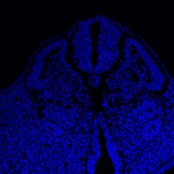 Protein expression in the human embryonic spinal cord