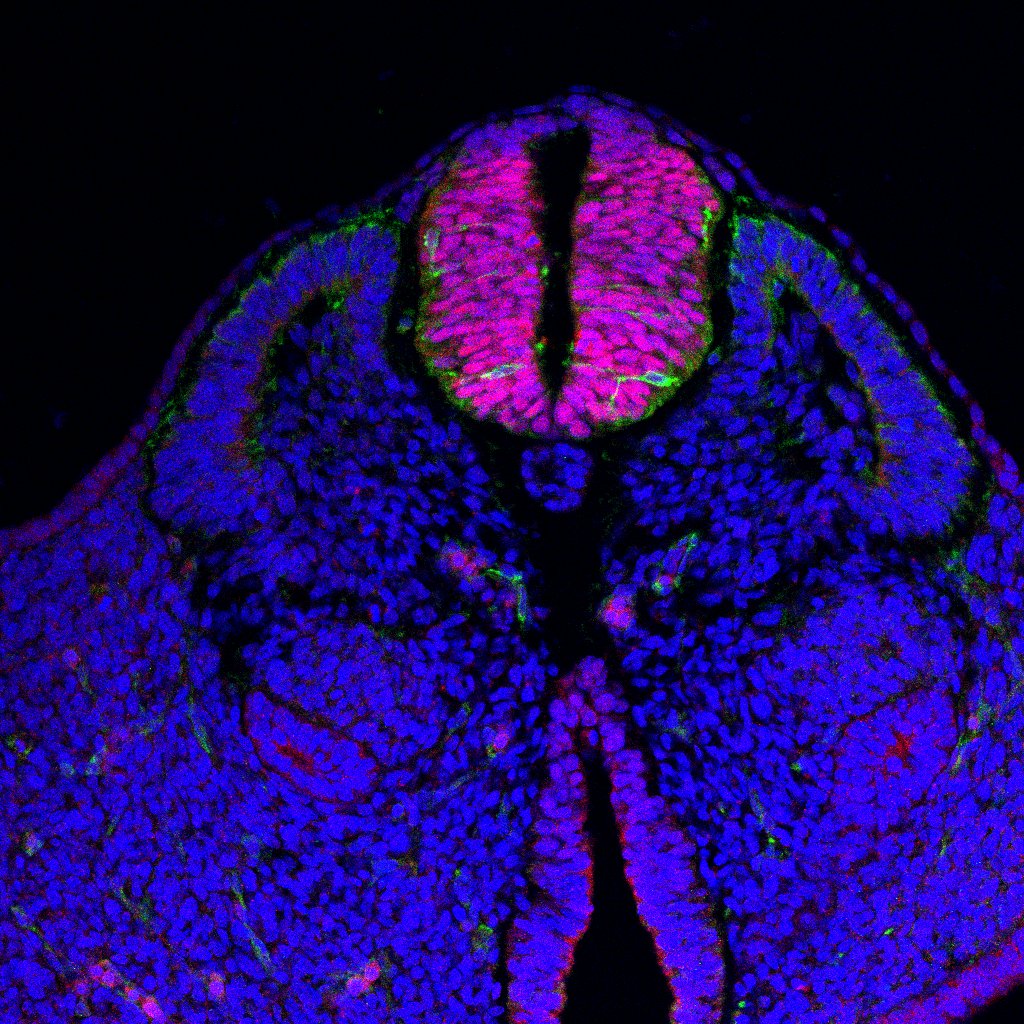 Protein expression in the human embryonic spinal cord