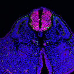 Protein expression in the human embryonic spinal cord