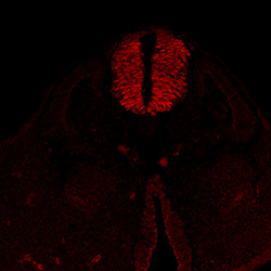 Protein expression in the human embryonic spinal cord