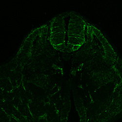 Protein expression in the human embryonic spinal cord