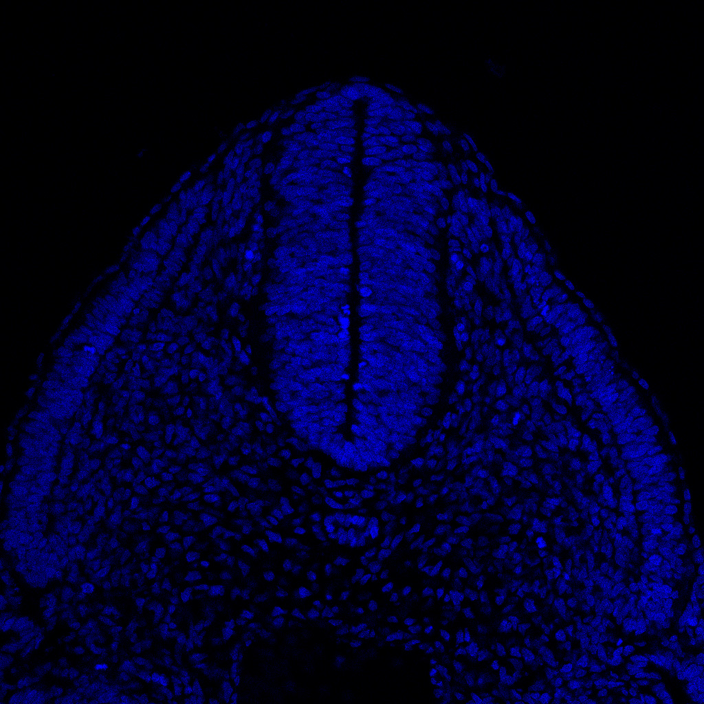 Protein expression in the human embryonic spinal cord