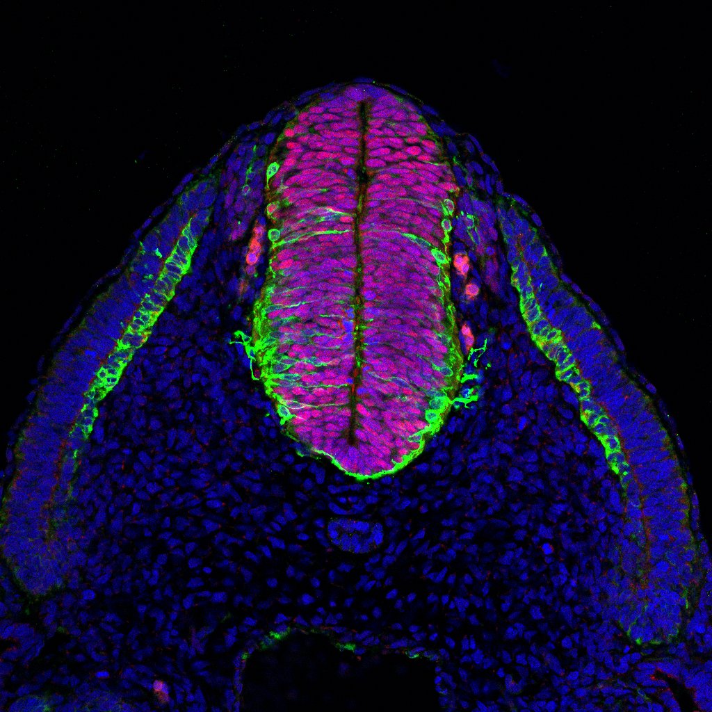 Protein expression in the human embryonic spinal cord