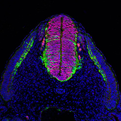 Protein expression in the human embryonic spinal cord