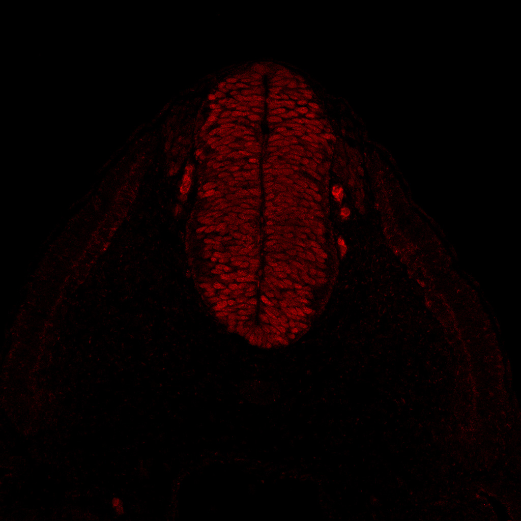 Protein expression in the human embryonic spinal cord