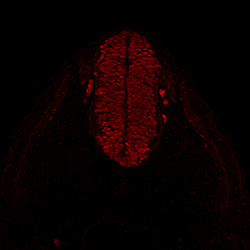Protein expression in the human embryonic spinal cord