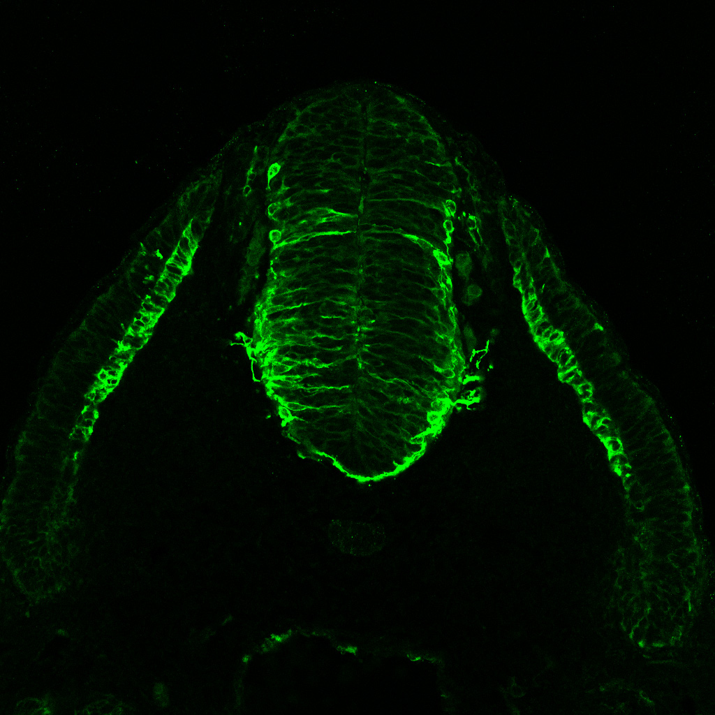 Protein expression in the human embryonic spinal cord