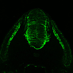 Protein expression in the human embryonic spinal cord