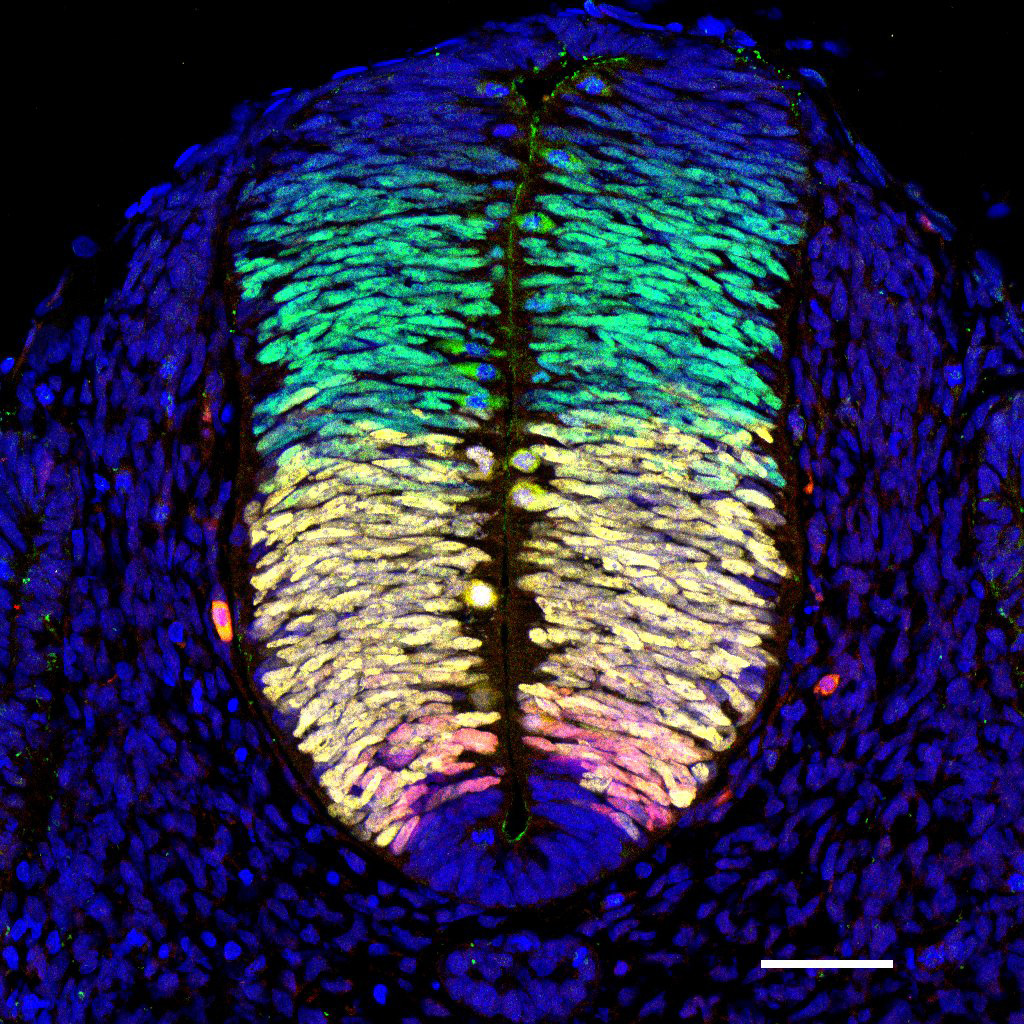 Gene expression in the human embryonic spinal cord