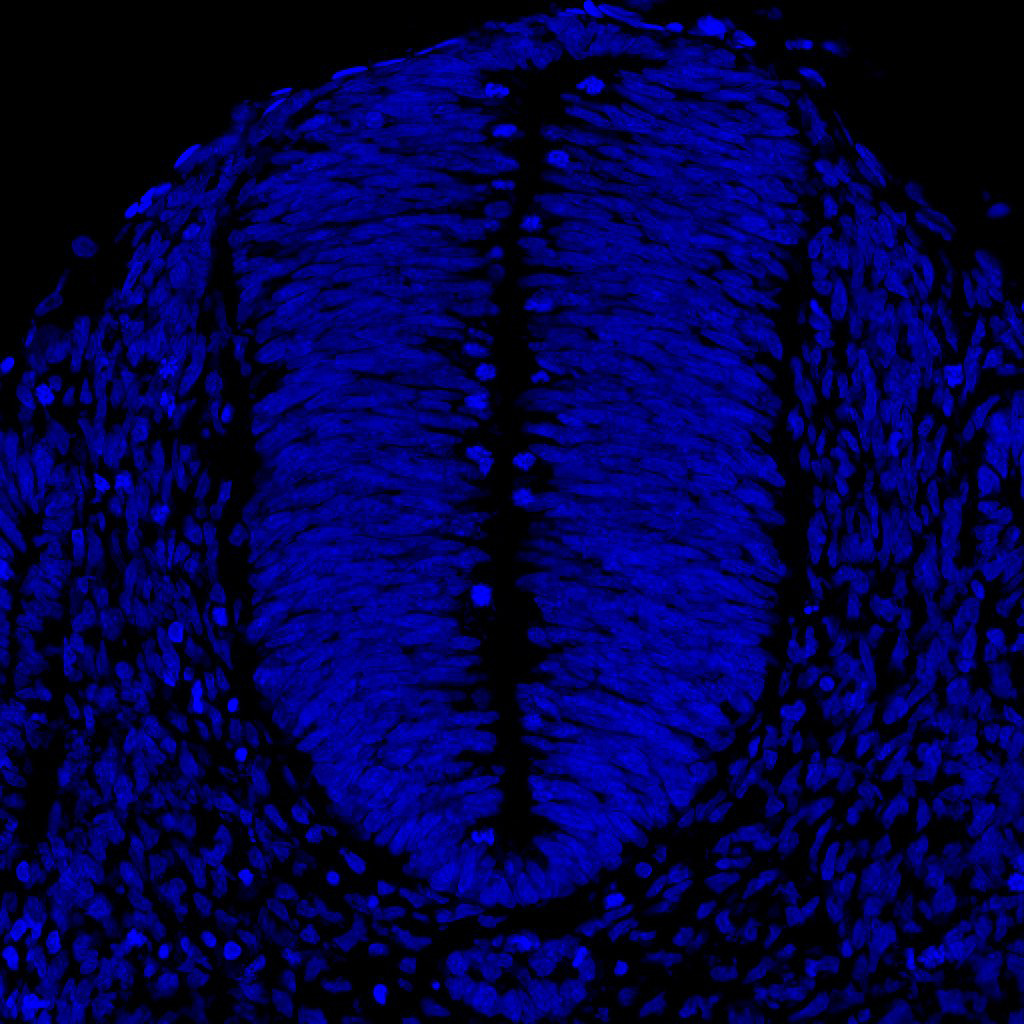 Gene expression in the human embryonic spinal cord