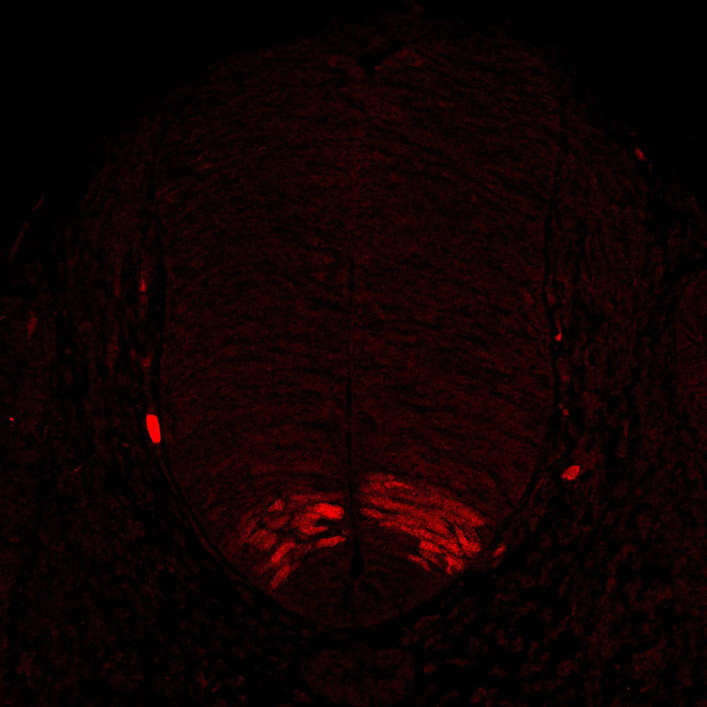 Gene expression in the human embryonic spinal cord