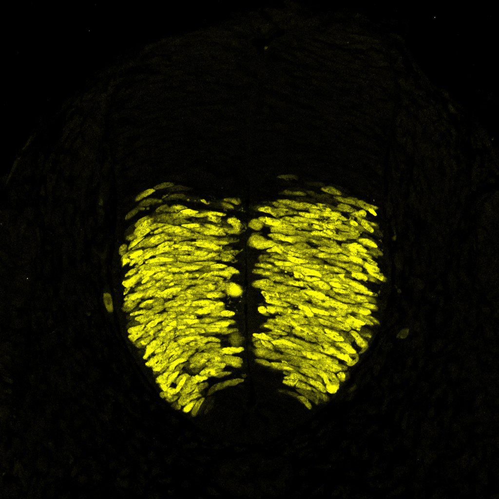 Gene expression in the human embryonic spinal cord
