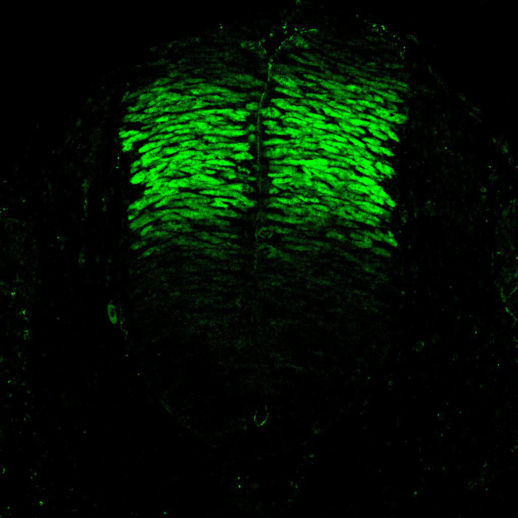 Gene expression in the human embryonic spinal cord