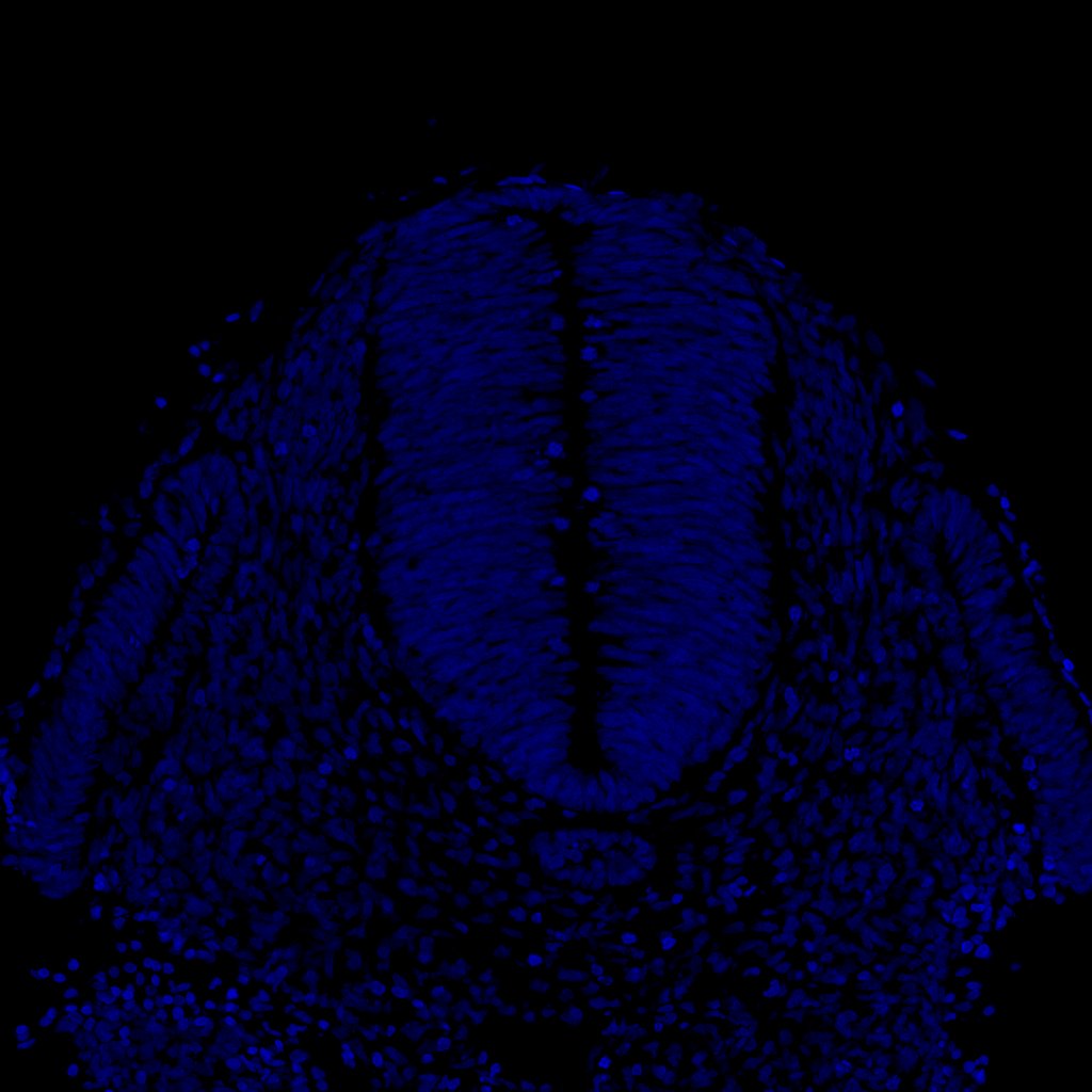 Gene expression in the human embryonic spinal cord