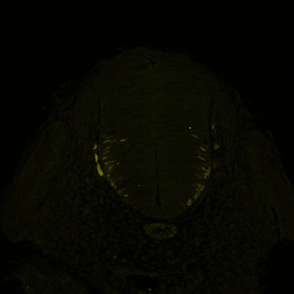 Gene expression in the human embryonic spinal cord