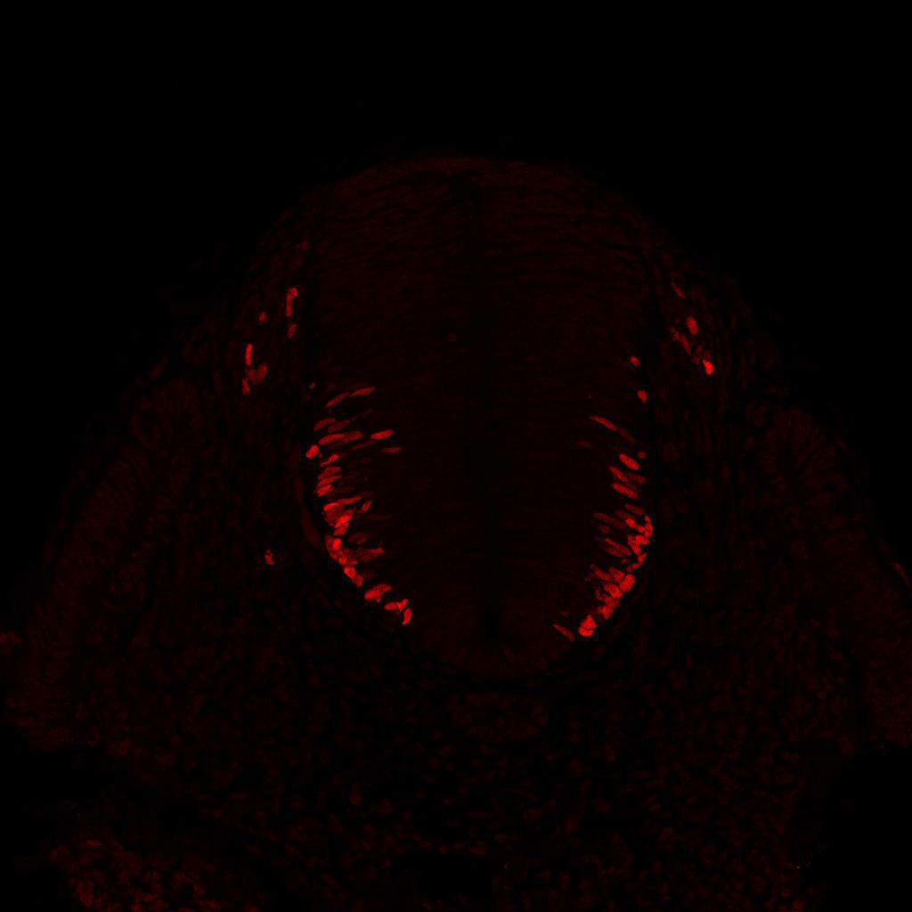 Gene expression in the human embryonic spinal cord