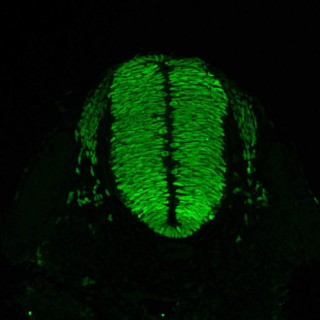 Gene expression in the human embryonic spinal cord
