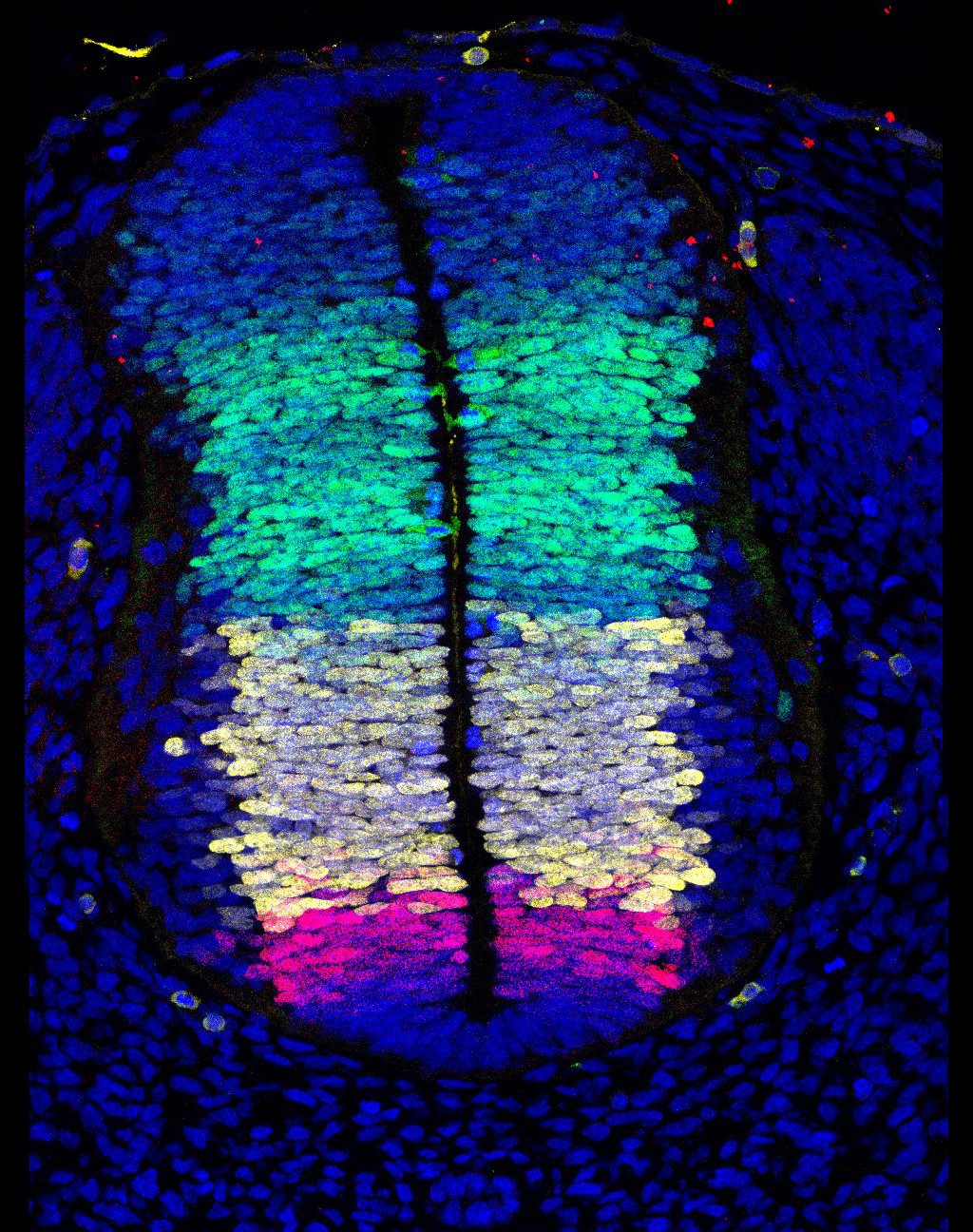 Gene expression in the human embryonic spinal cord
