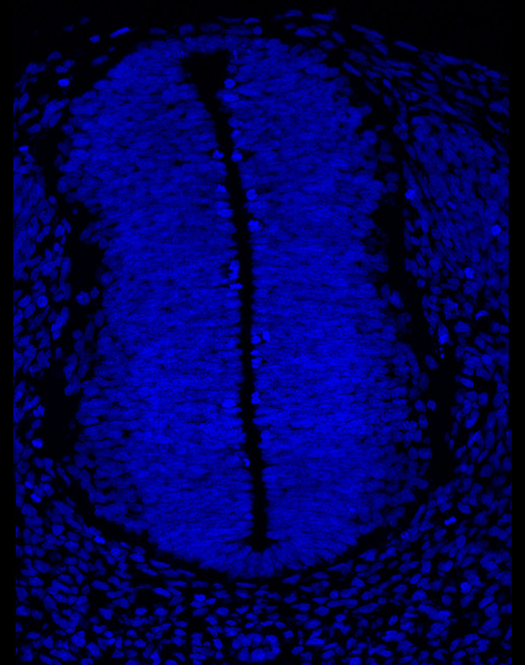 Gene expression in the human embryonic spinal cord