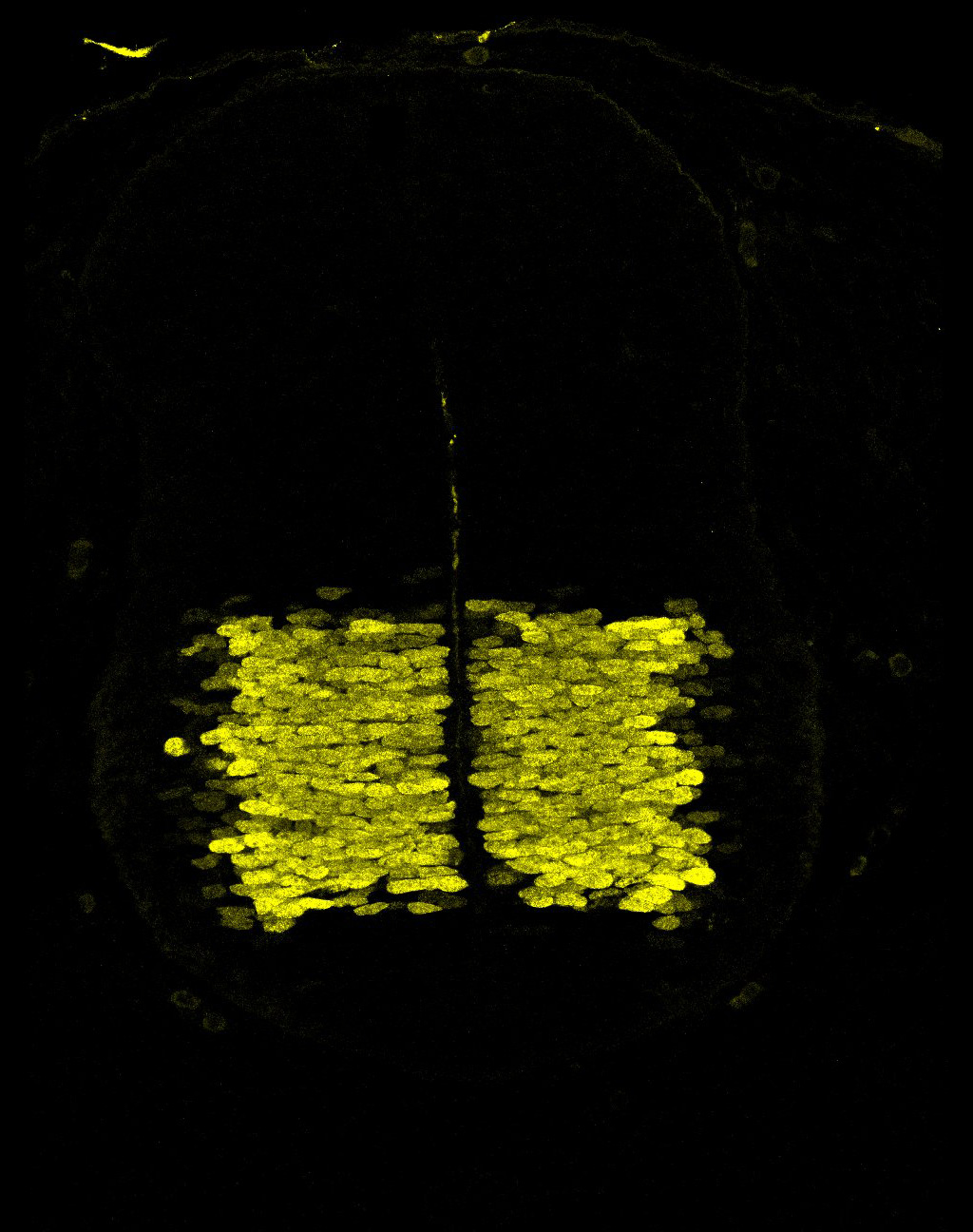 Gene expression in the human embryonic spinal cord