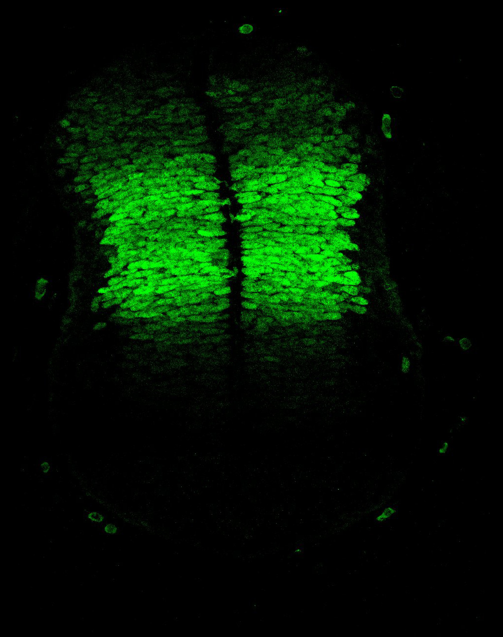 Gene expression in the human embryonic spinal cord