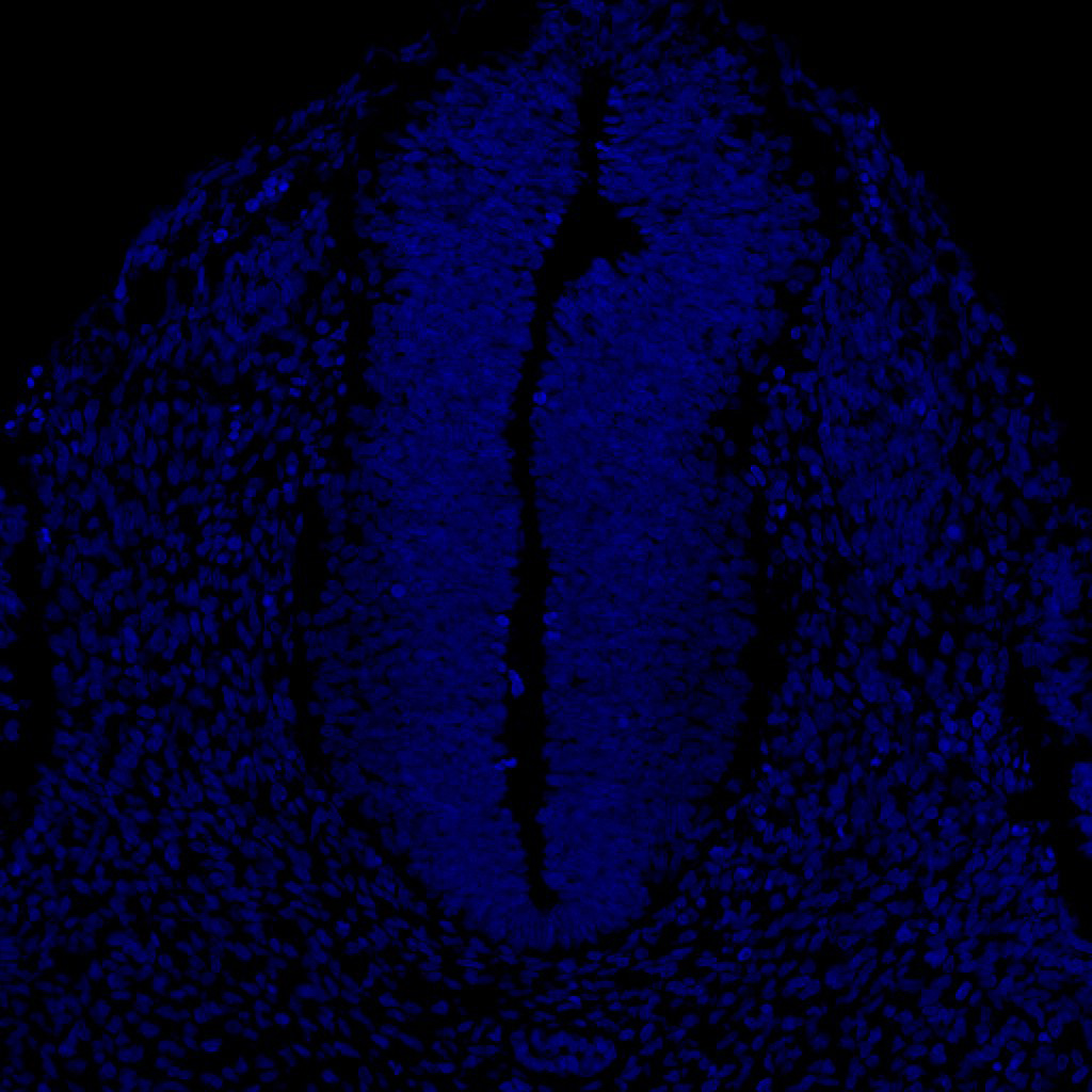Gene expression in the human embryonic spinal cord