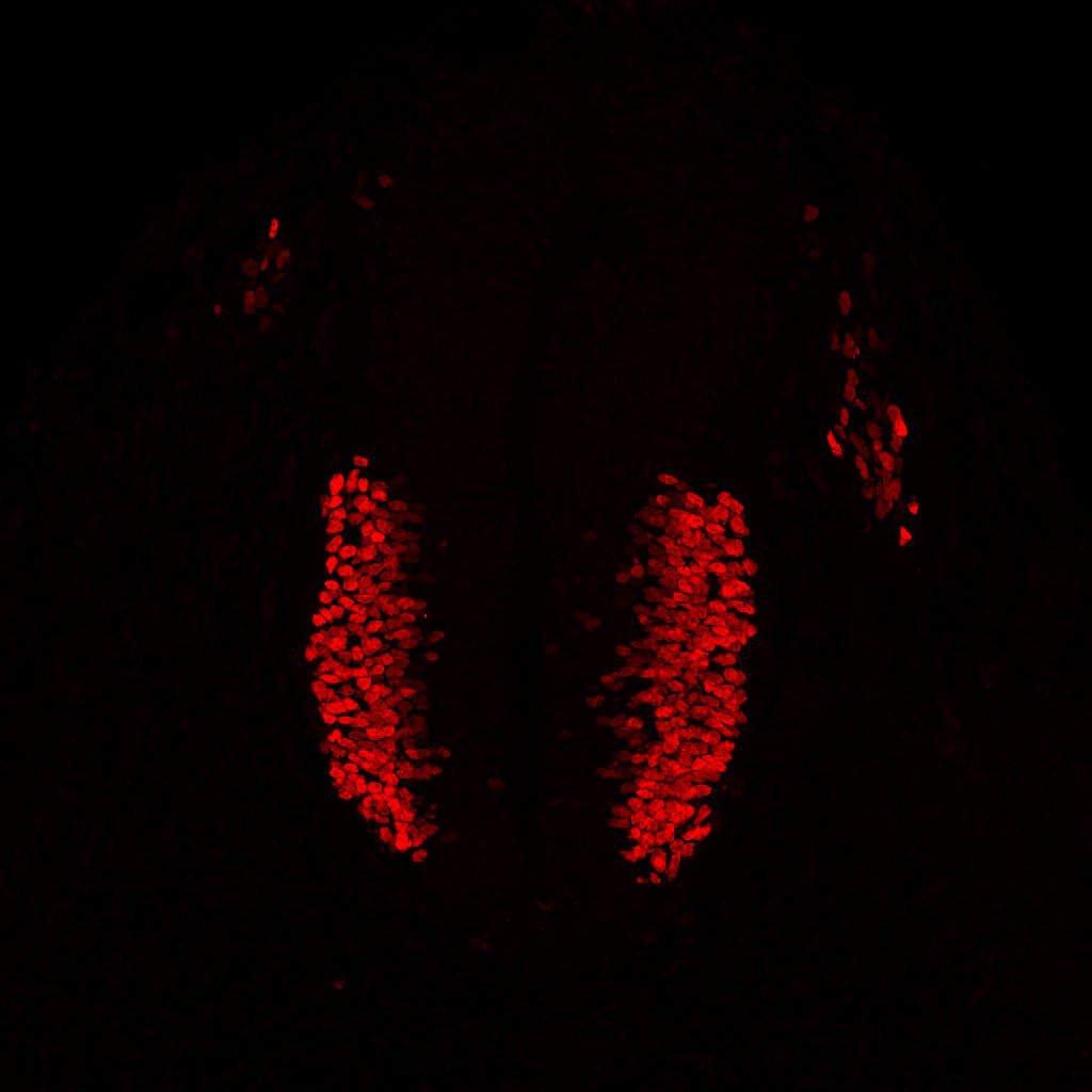 Gene expression in the human embryonic spinal cord