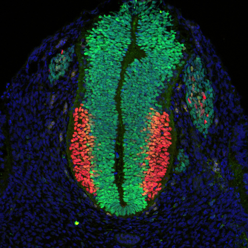 Gene expression in the human embryonic spinal cord