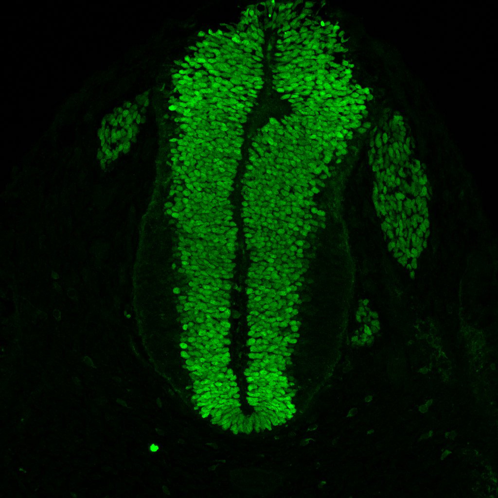 Gene expression in the human embryonic spinal cord