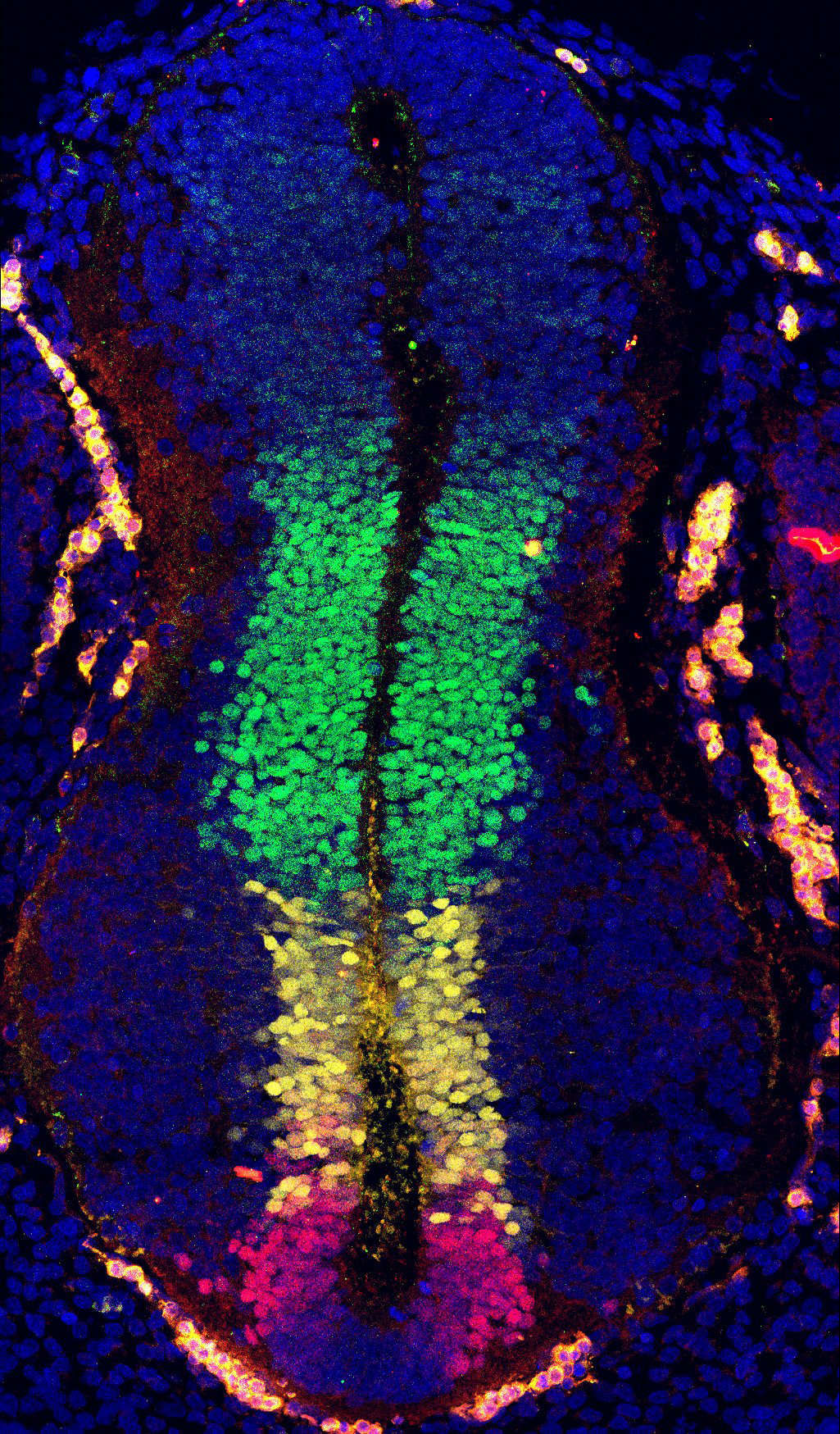 Gene expression in the human embryonic spinal cord