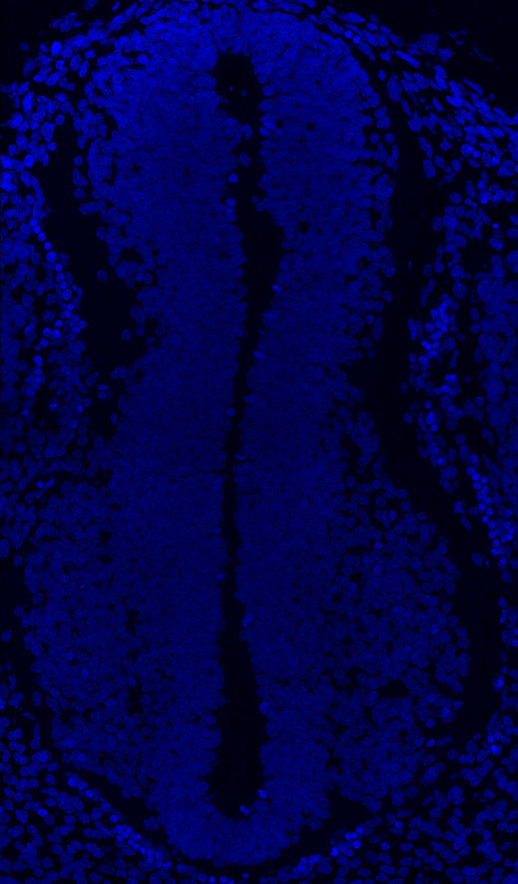 Gene expression in the human embryonic spinal cord