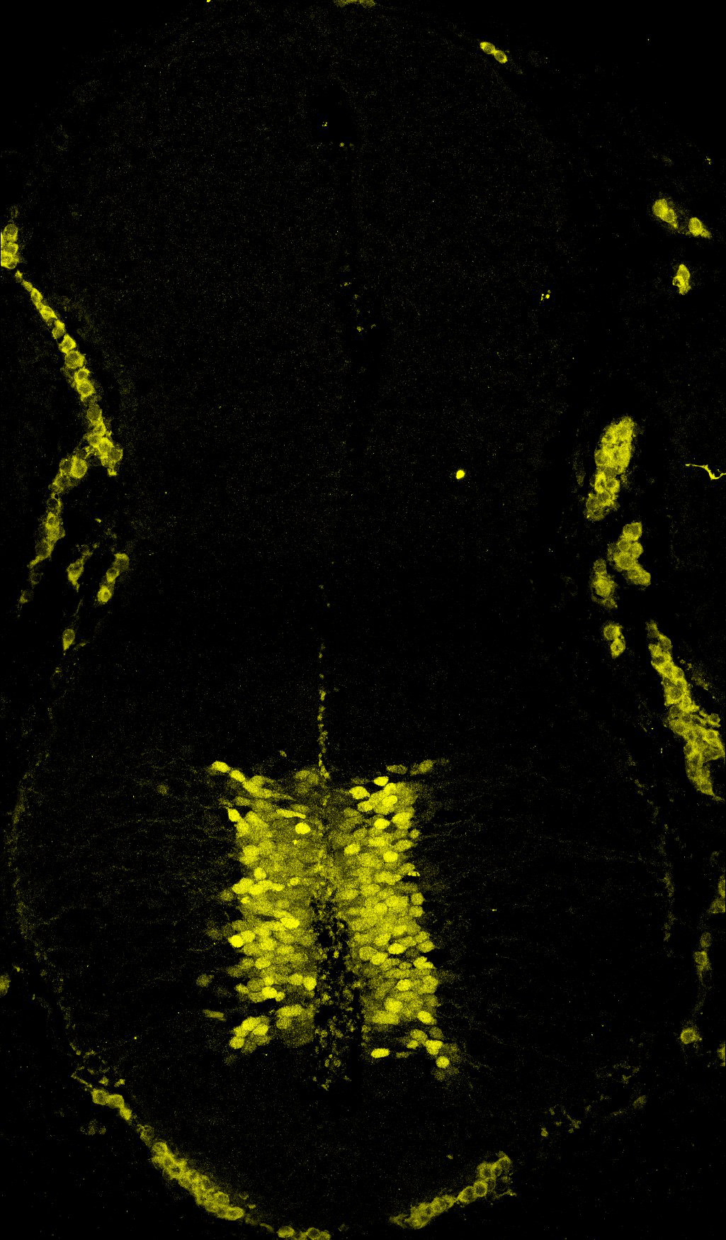 Gene expression in the human embryonic spinal cord
