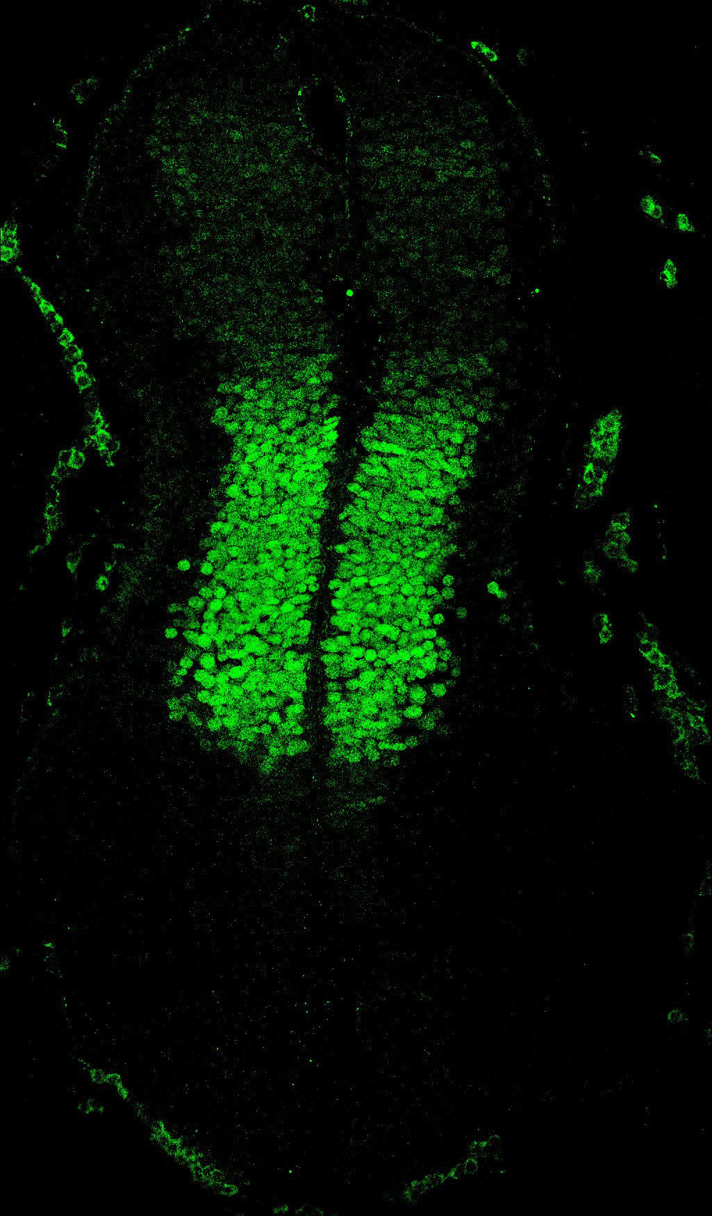 Gene expression in the human embryonic spinal cord