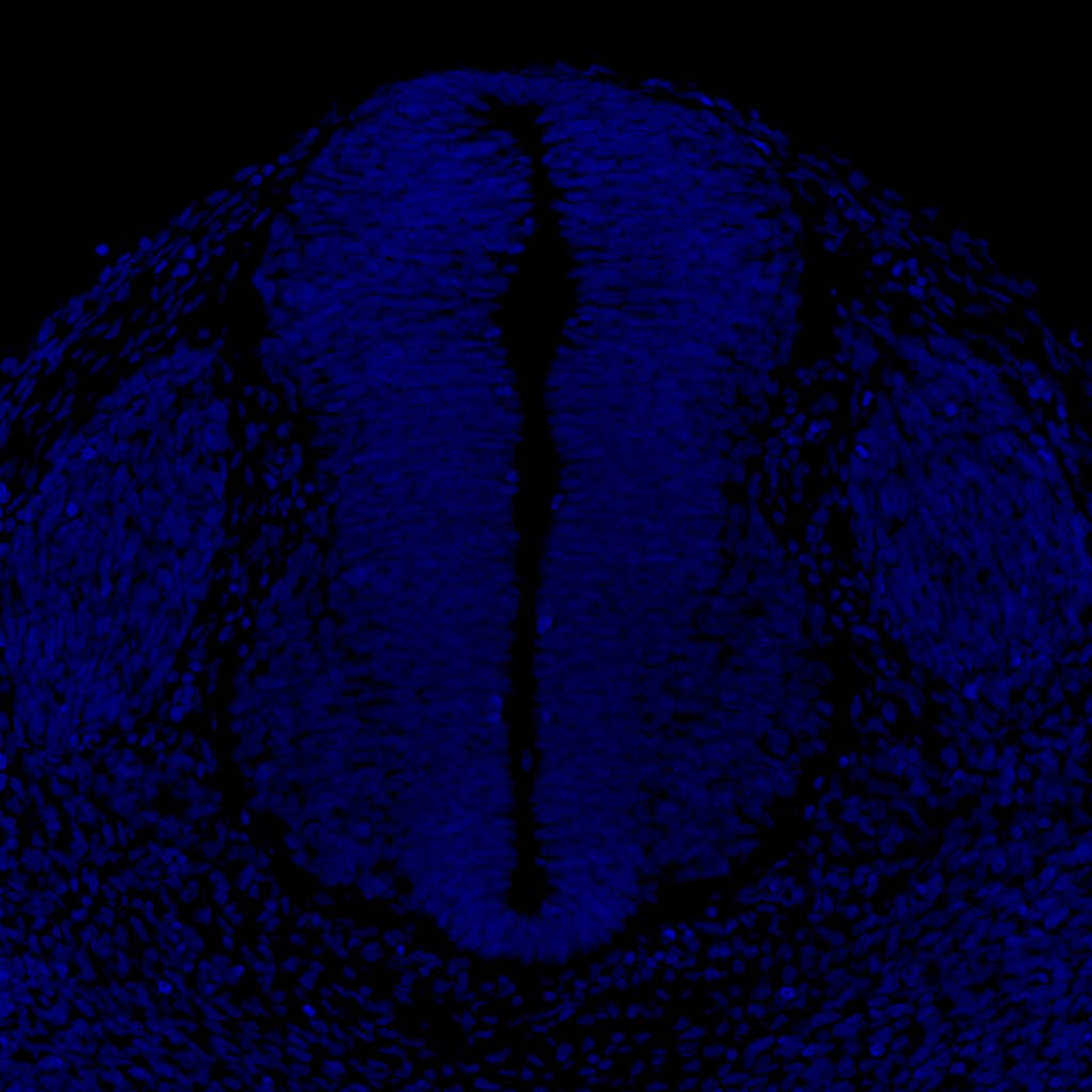 Gene expression in the human embryonic spinal cord