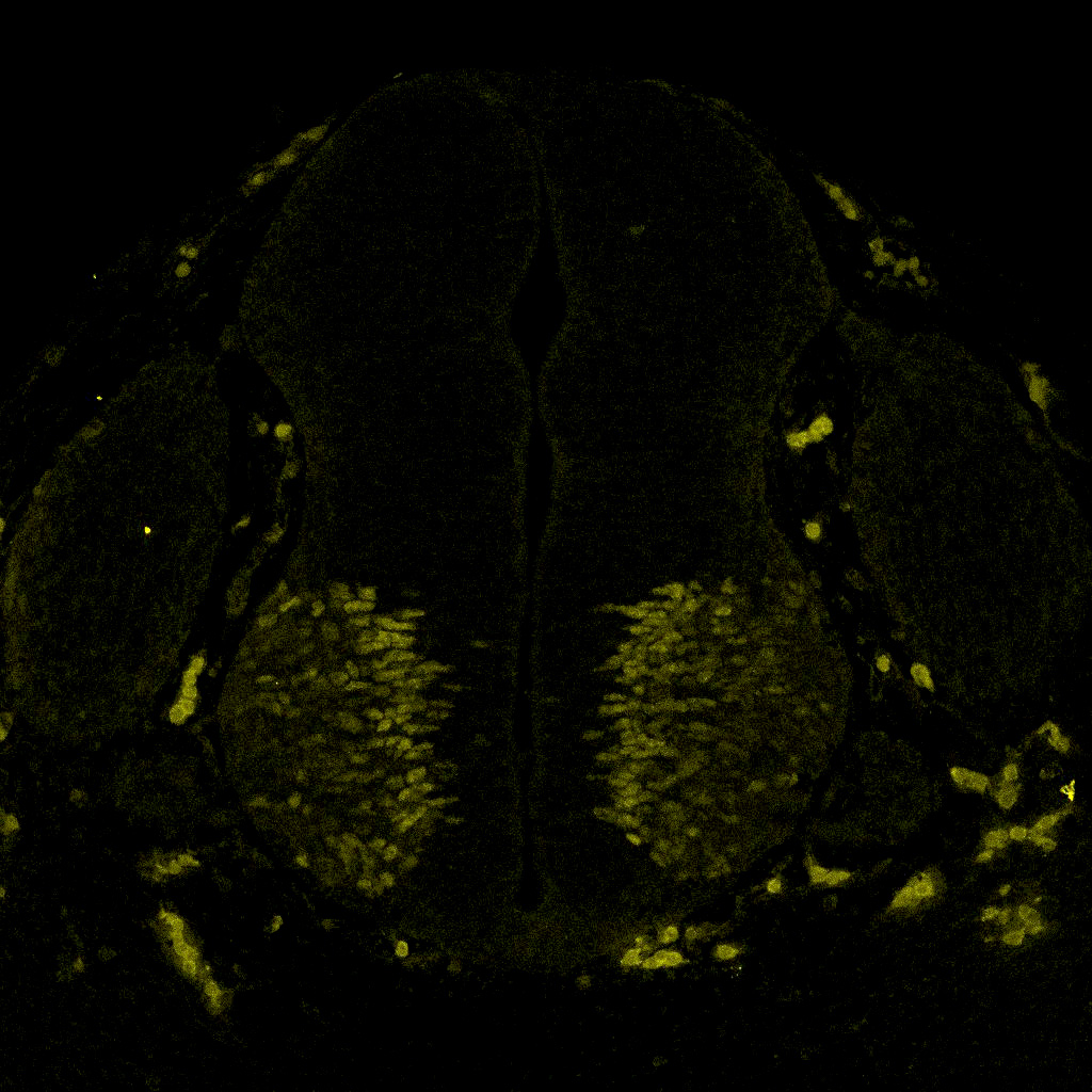 Gene expression in the human embryonic spinal cord