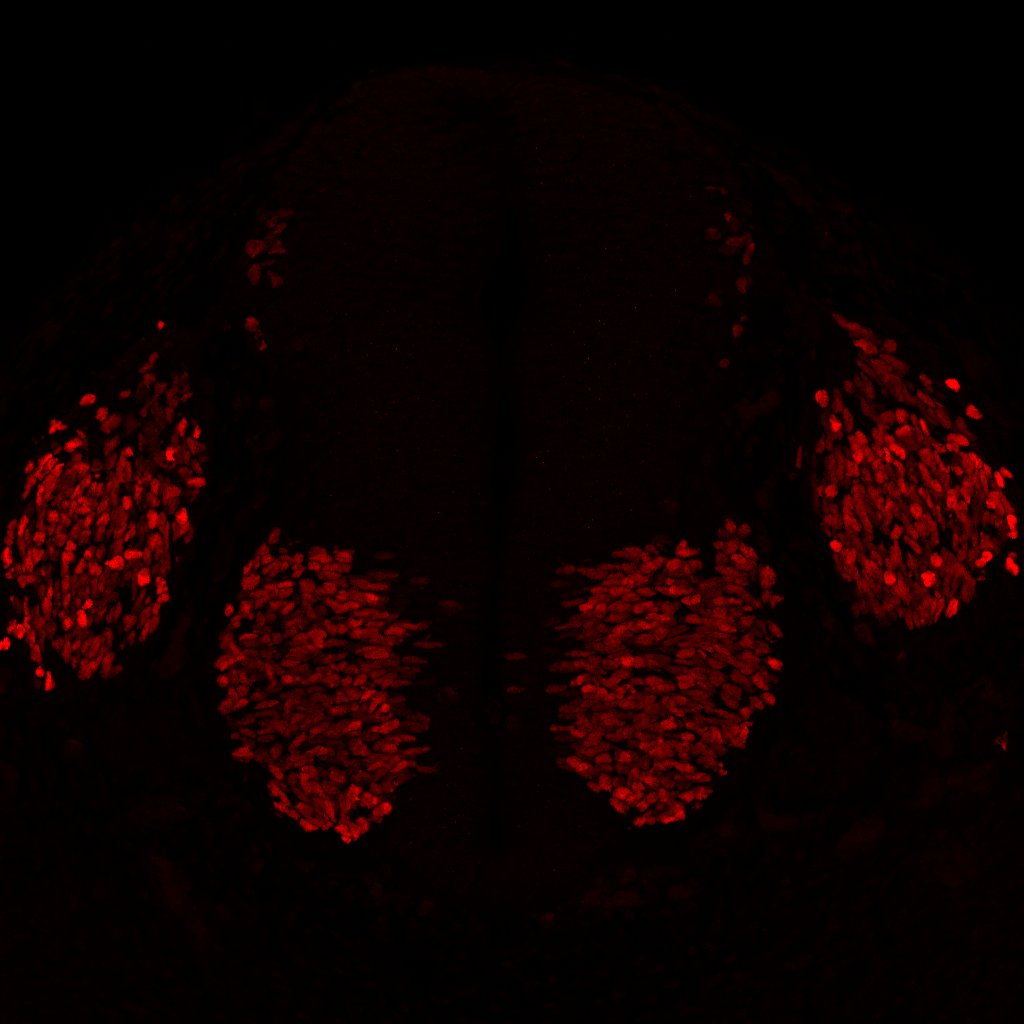 Gene expression in the human embryonic spinal cord