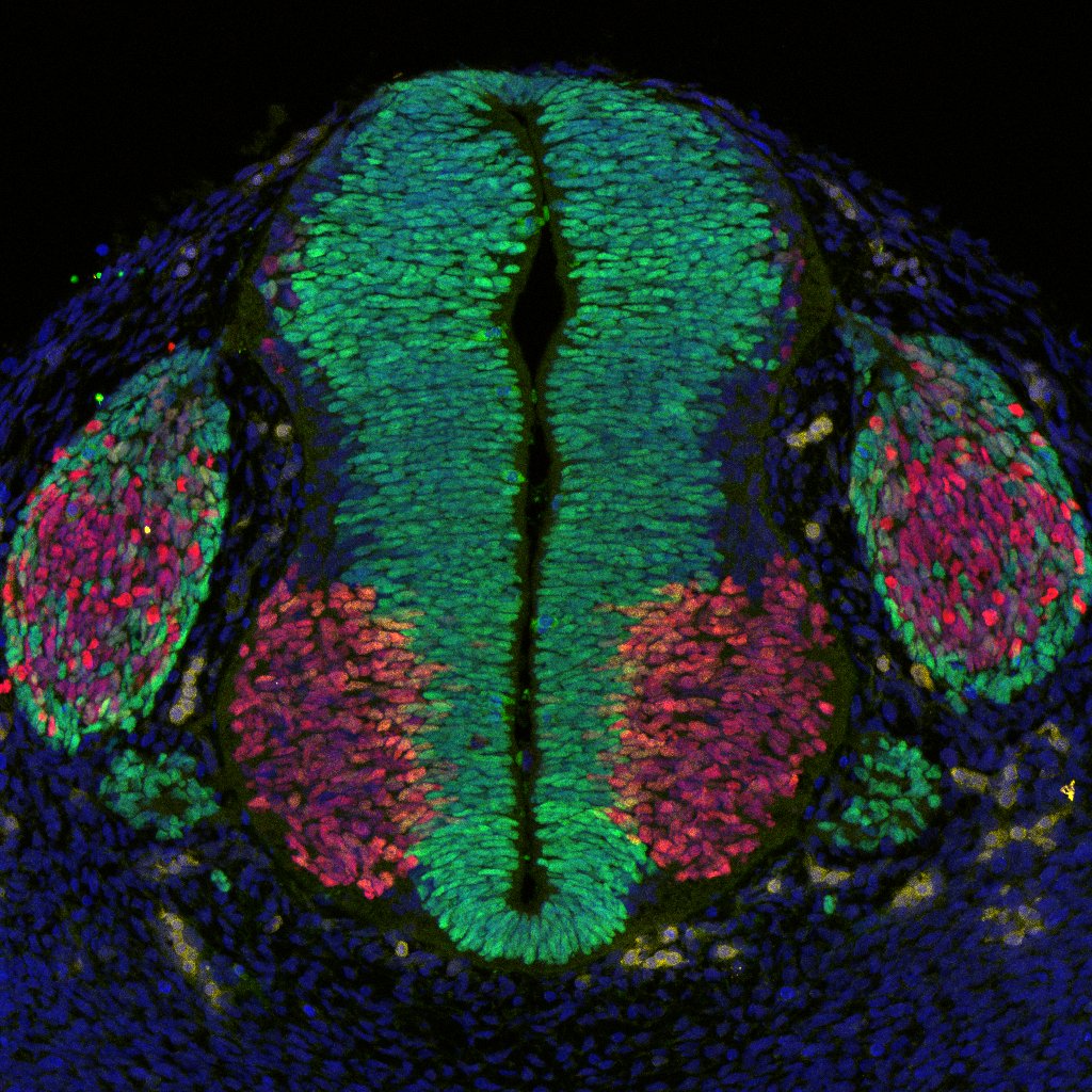 Gene expression in the human embryonic spinal cord