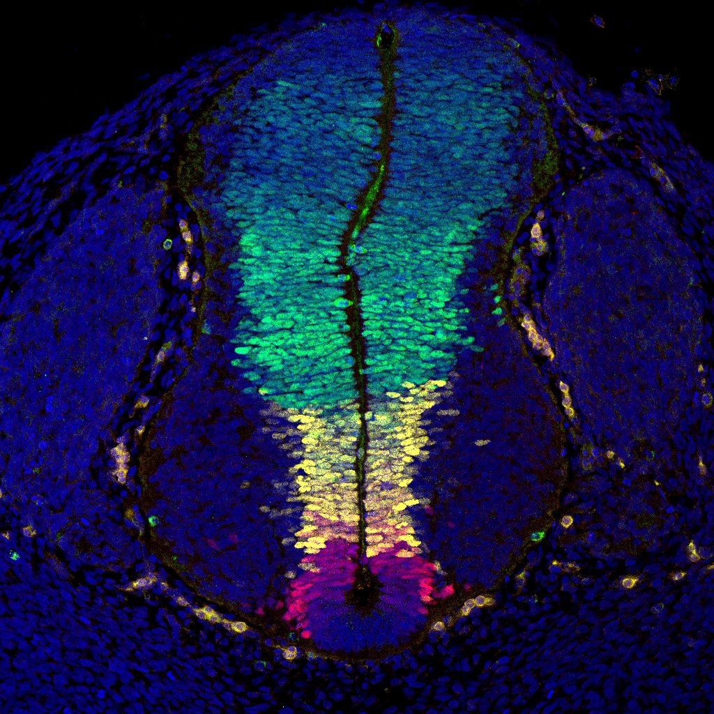 Gene expression in the human embryonic spinal cord