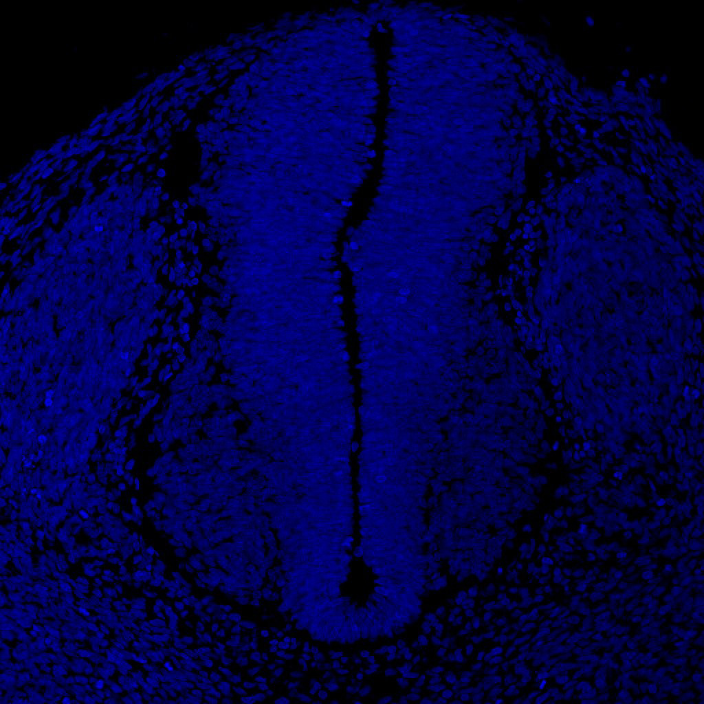 Gene expression in the human embryonic spinal cord