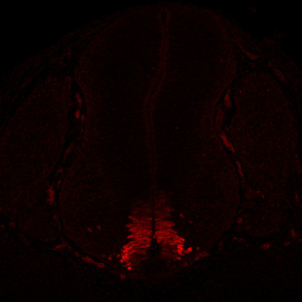 Gene expression in the human embryonic spinal cord