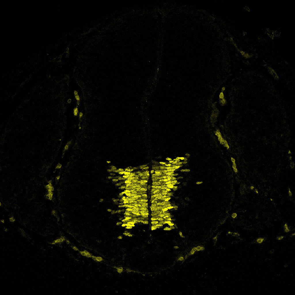 Gene expression in the human embryonic spinal cord