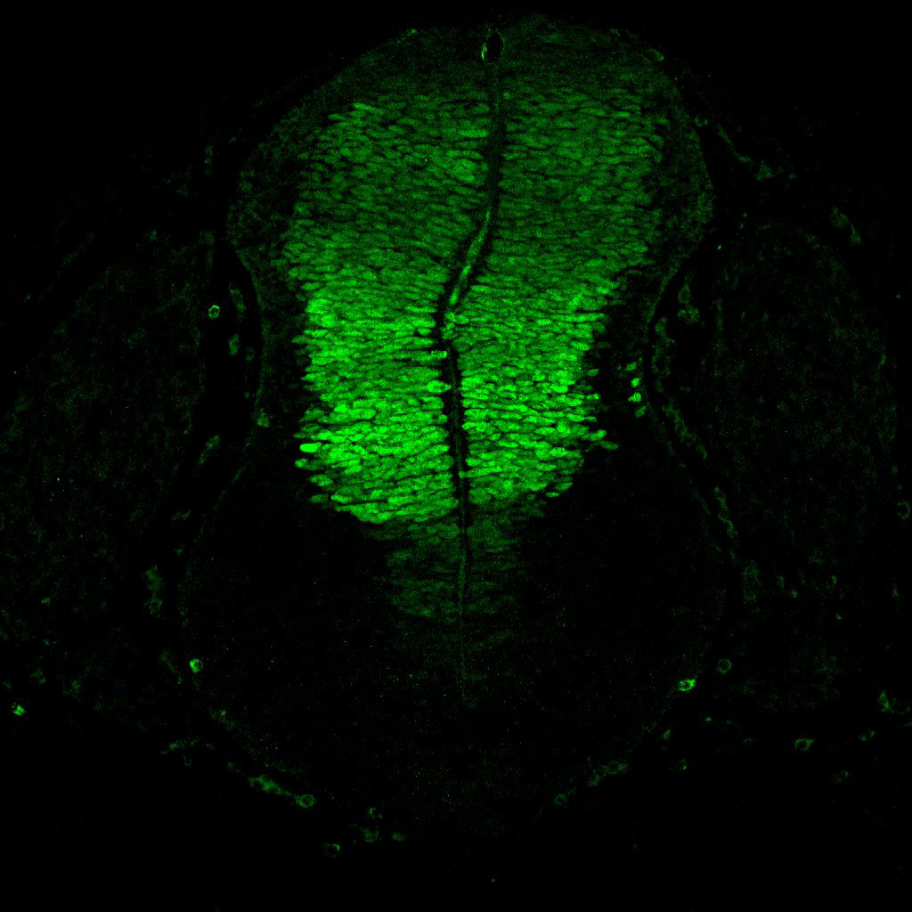 Gene expression in the human embryonic spinal cord