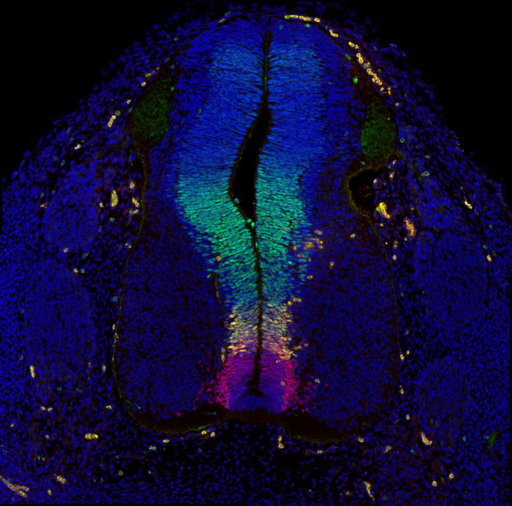 Gene expression in the human embryonic spinal cord