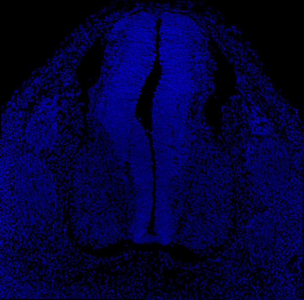 Gene expression in the human embryonic spinal cord