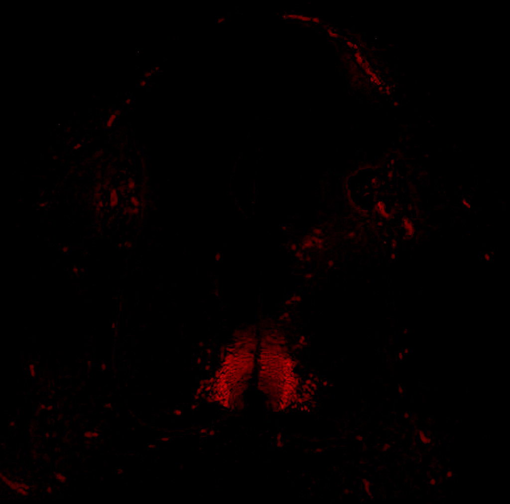 Gene expression in the human embryonic spinal cord