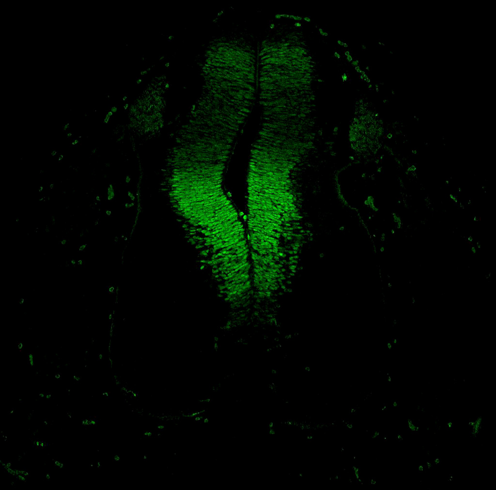 Gene expression in the human embryonic spinal cord