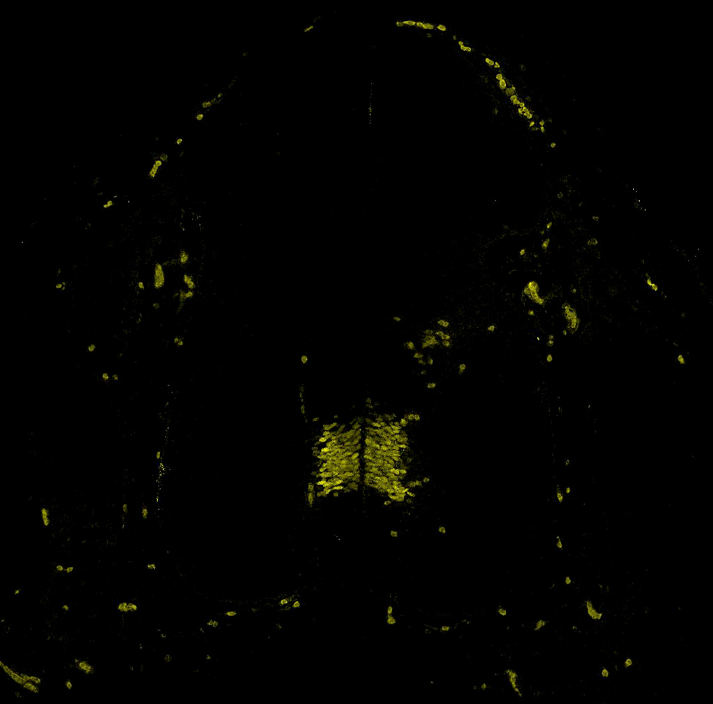 Gene expression in the human embryonic spinal cord