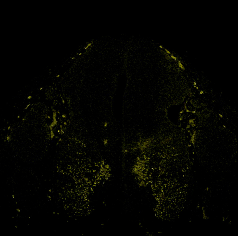 Gene expression in the human embryonic spinal cord